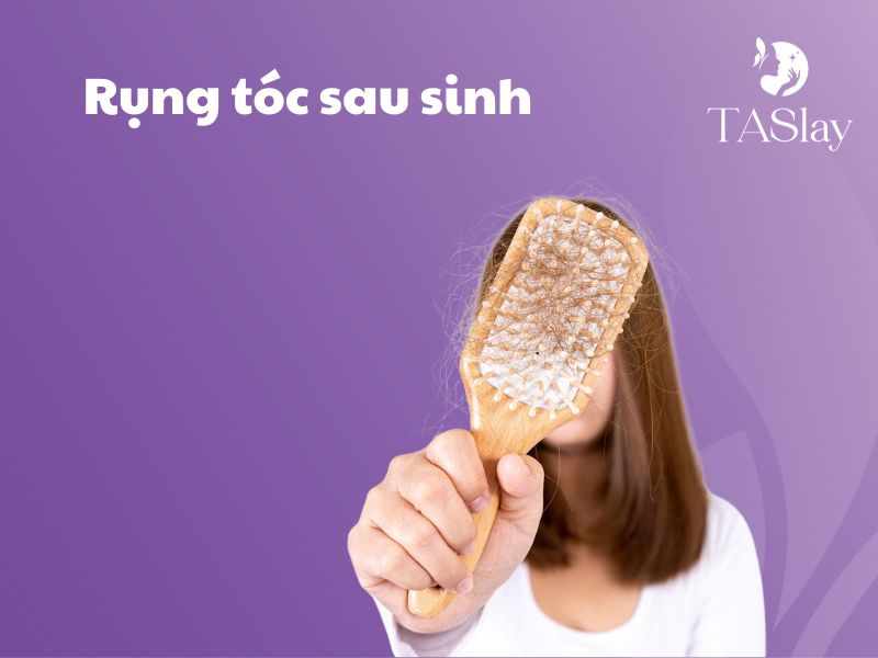 Cách ngăn rụng tóc sau sinh