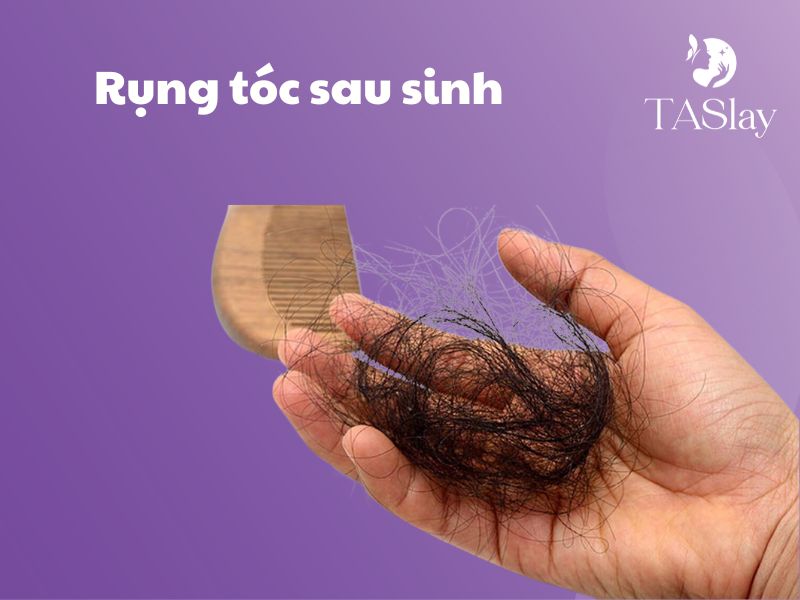 Cách ngăn rụng tóc sau sinh